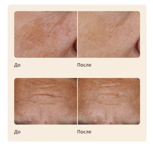 Artistry LongXevity™ Насыщенный восстанавливающий крем для лица (сменный блок), 50гр